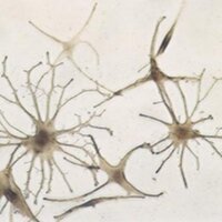 melanocyte